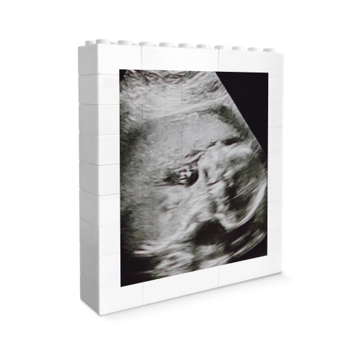 Personalised Baby Scan Photo Plaque Pregnancy Annoucement Gifts